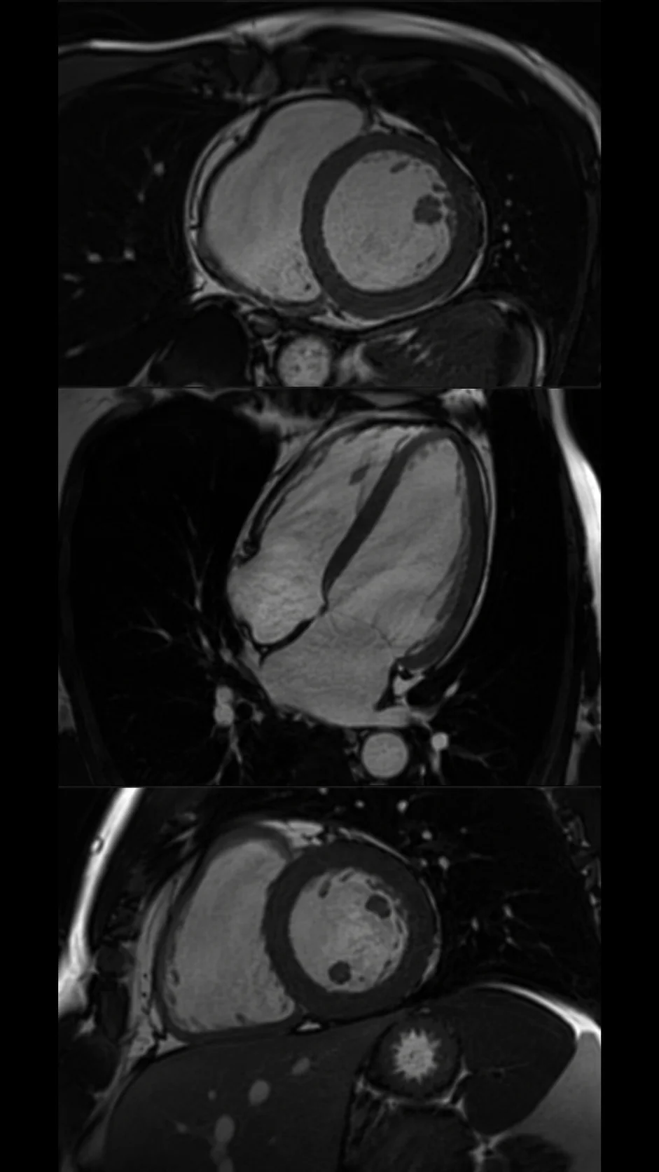 Cardiac imaging result